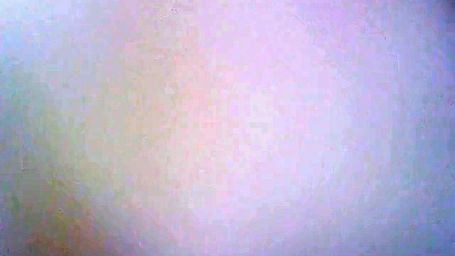 examination of the urethra and bladder with an endoscope