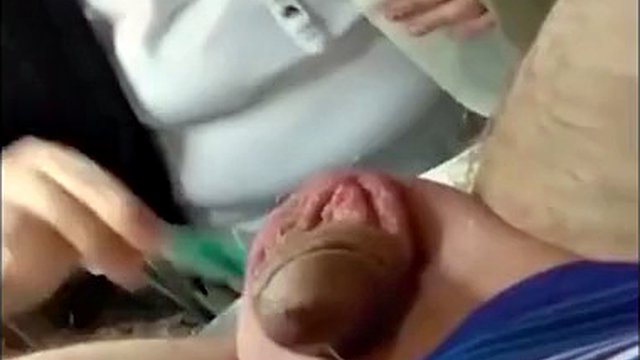 Men's Brazilian waxing - no gloves needed