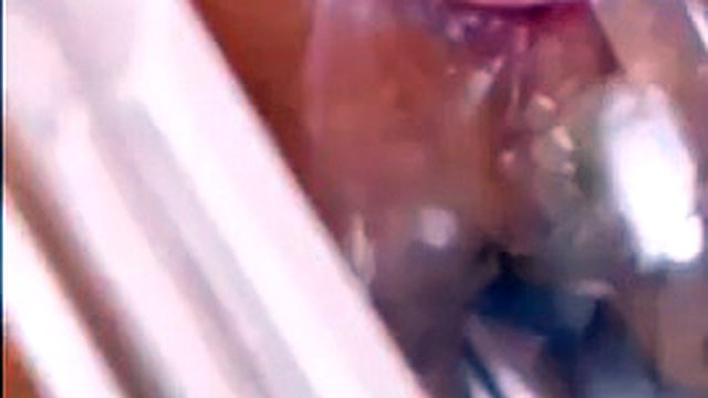 Vagina, cervix Rhythmically hit the orgasm vaginal endoscope with strong suction, squeezing and raising the spike.